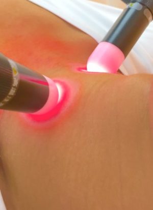 星状神経節に近赤外線照射