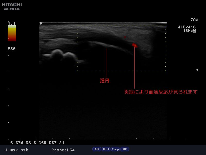 92_20161028_msk-ussb_0006