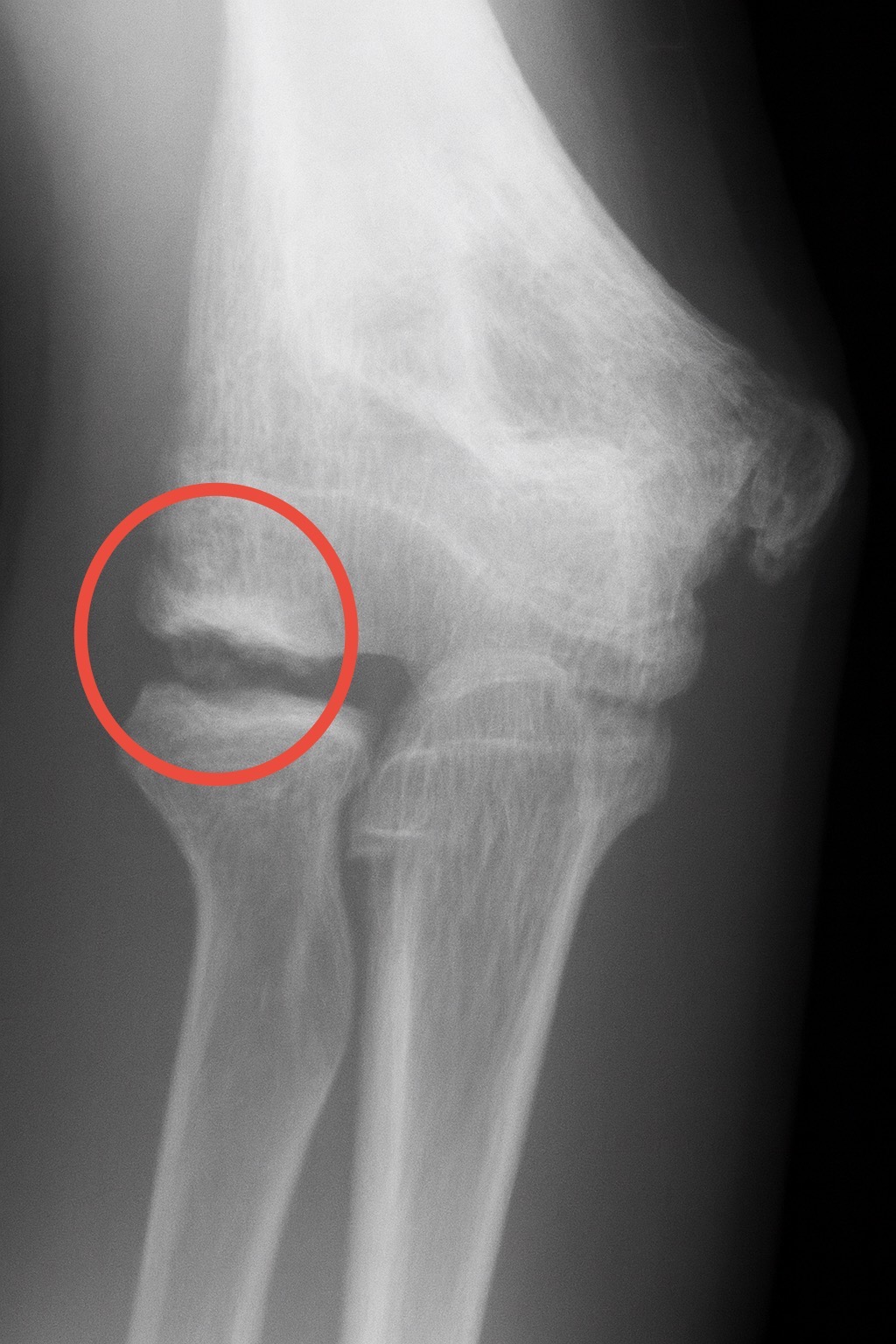 レントゲンではどのように写るの?