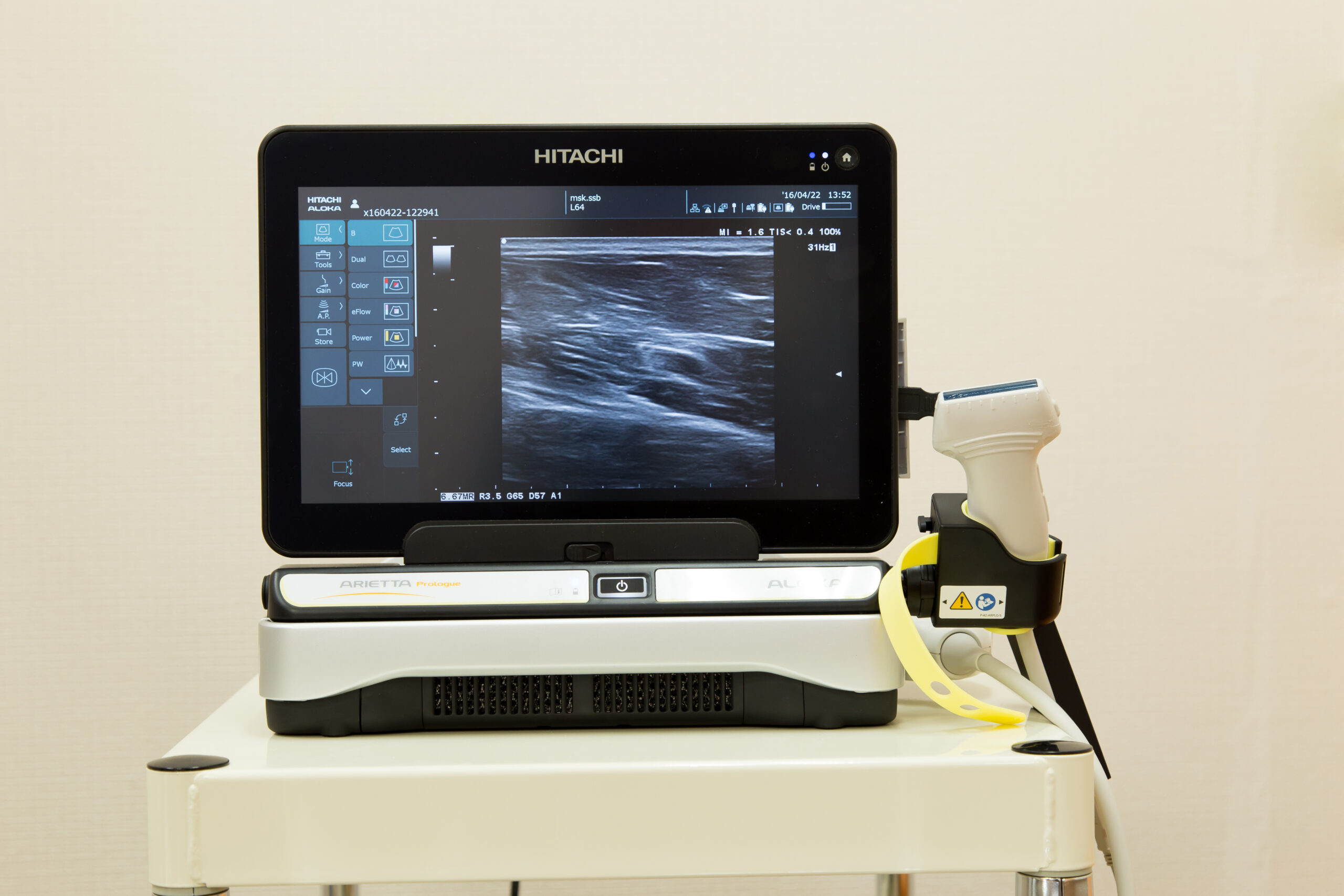 エコー(超音波観察装置)ではどうやってみえるの？